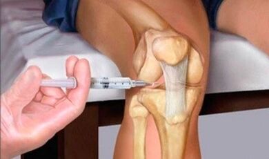 Hyaluronic acid has joints