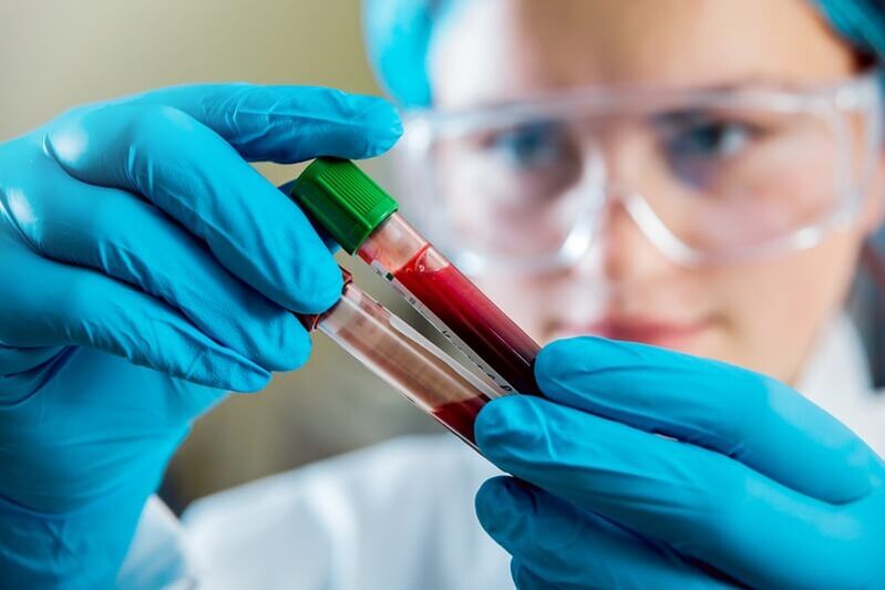 Complete blood tests to diagnose low back pain